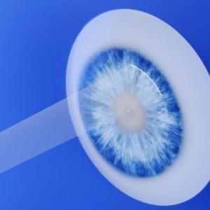 SMILE Laser Eye Surgery Talks