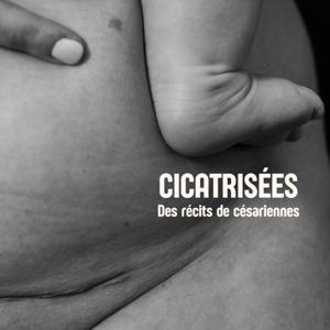 Cicatrisées