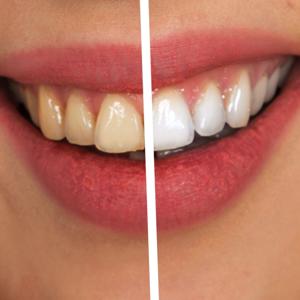 The Confident Smile Podcast: Practical Dental Care for Everyday Life
