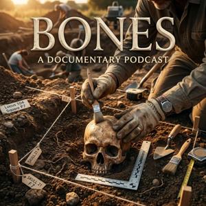 Bones