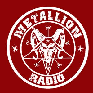 MetallionRadio