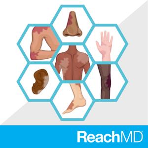 Psoriasis: What’s Beneath the Surface