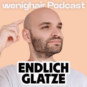 wenighair Podcast – Haarausfall? Endlich Glatze!